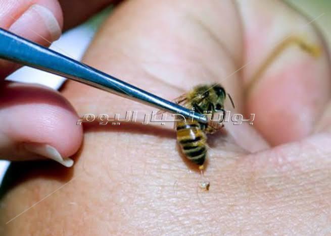  العلاج بسم النحل