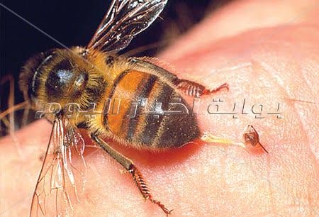  العلاج بسم النحل