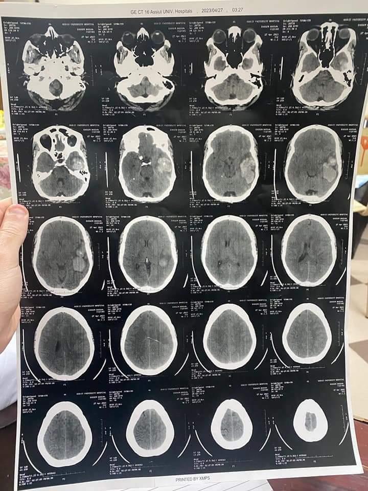  فريق طبي بوحدة جراحة شرايين وأوردة المخ