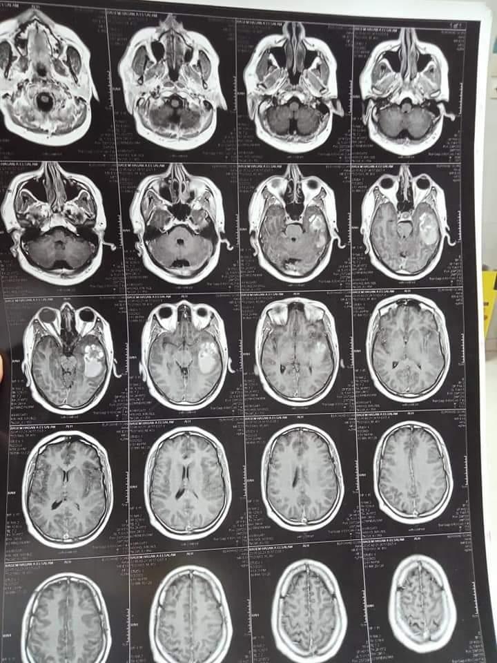  فريق طبي بوحدة جراحة شرايين وأوردة المخ