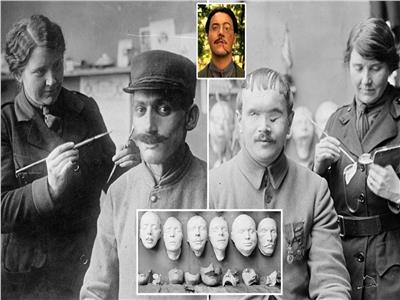 مهمة ترميم الوجوه.. أصعب محاولات علاج مصابي الحرب العالمية الأولى (صور)