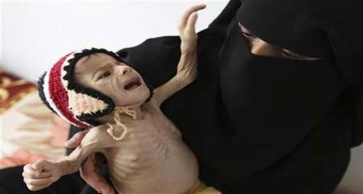 برنامج الأغذية العالمي: نصف اليمنيين يعانون من الجوع بعد الثورة