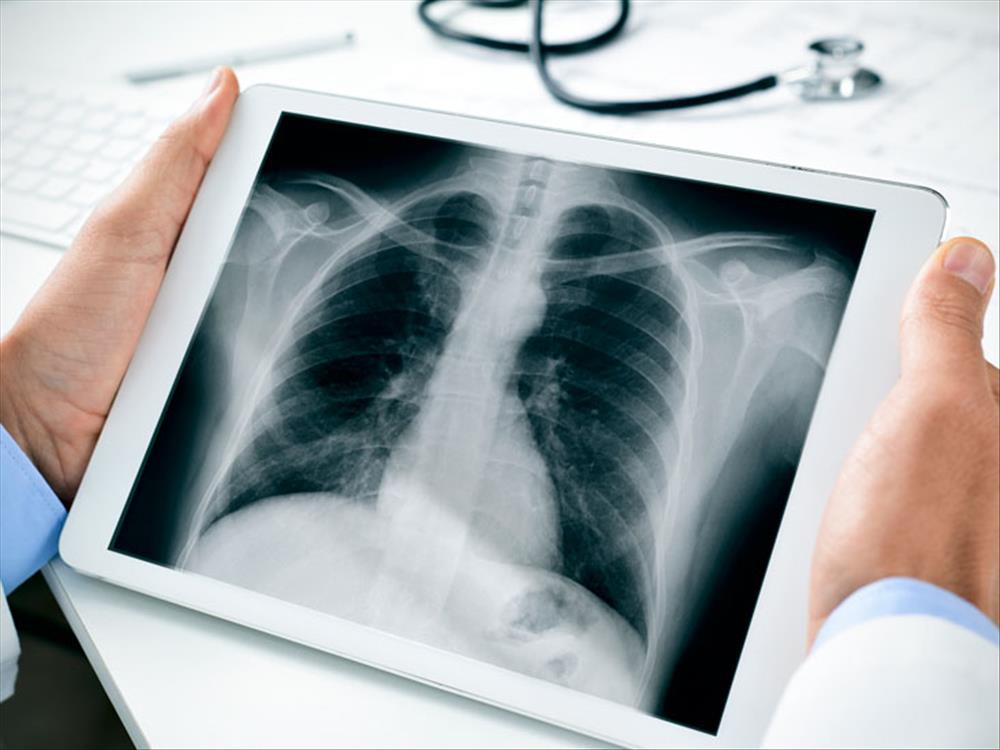 تجنب عمل الأشعة غير الضرورية على الصدر