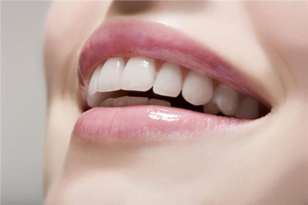 تقنية فينير الأسنان أحدث طرق تجميل الأسنان