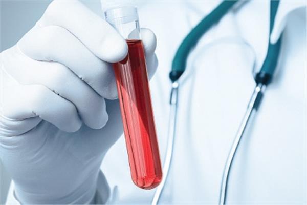 خبراء صحة بريطانيون يحذرون من الارتفاع"المزعج" فى حالات تعفن الدم بين الشباب