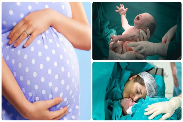 لماذا تعد الولادة القيصرية المفضلة لدى الحوامل