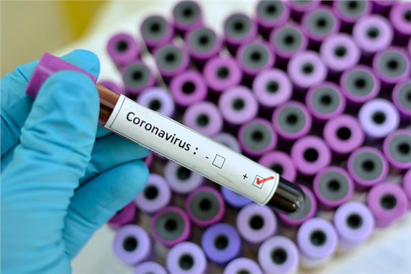 روسيا تكشف موعد إنتاج أول عقار لعلاج فيروس كورونا