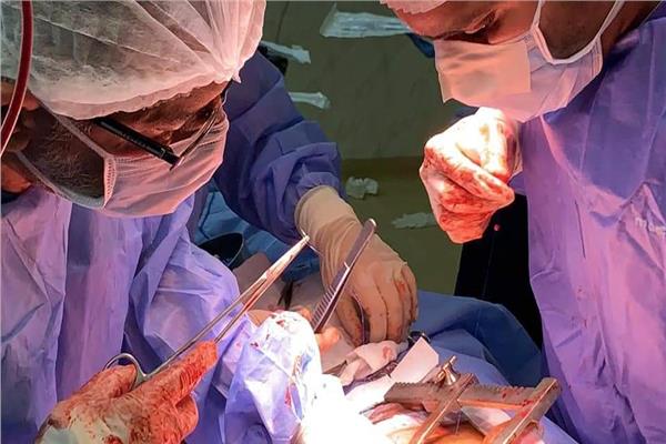 إجراءجراحة ناجحة لايقاف نزيف في قلب شرقاوي 