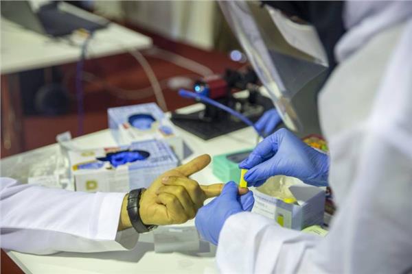 وزير الصحة الكويتي: شفاء 587 حالة مصابة بفيروس كورونا