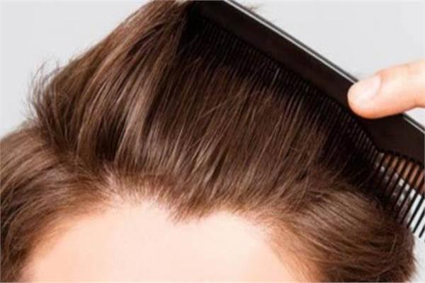 استشاري تجميل: حقن البلازما علاج فعال لحماية بصيلات الشعر الحية فقط