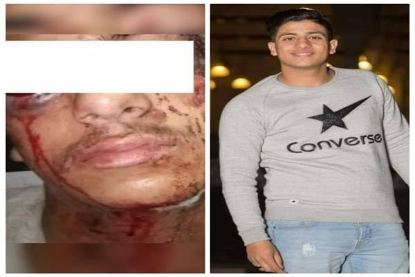 الشاب أحمد الضوي ضحية طلق ناري
