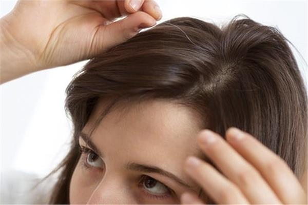 8 وصفات طبيعية لحماية شعرك من الشيب