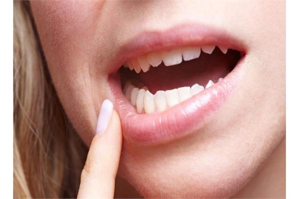 10 علامات تدل على الإصابة بسرطان الفم 