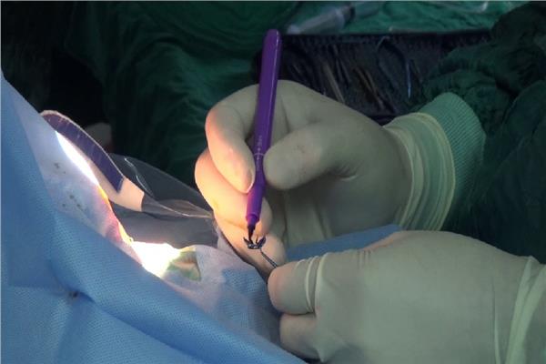 10 عمليات جراحية بجامعة المنيا