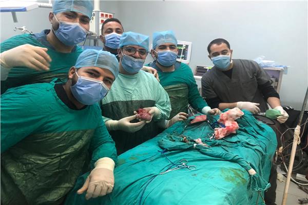 جراحة نادرة بمستشفيات جامعة المنيا
