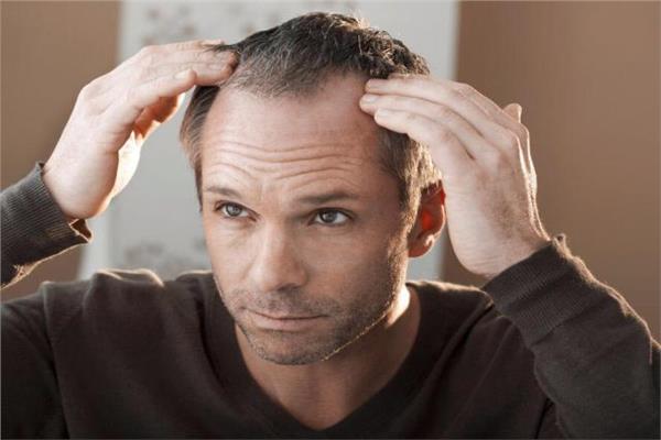 طرق ونصائح هامة لتكثيف الشعر للرجال