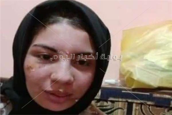 إسراء عماد ضحية عنف زوجها