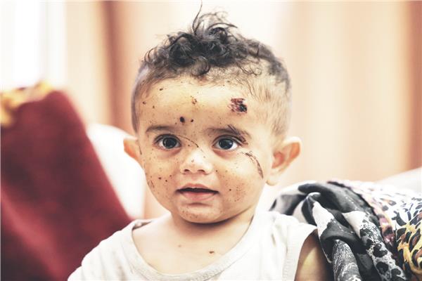 اثار العدوان الاسرائيلى تبدو على وجه هذا الطفل الذى دمر الاحتلال منزله فى غزة