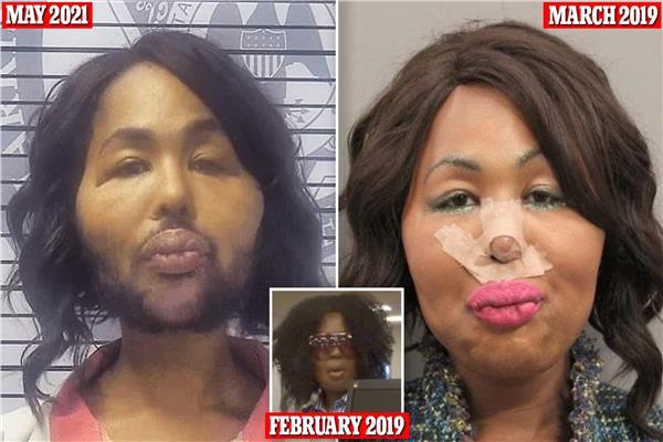 متحولة جنسيا تسرق مصرف بنكي من أجل عمليات التجميل