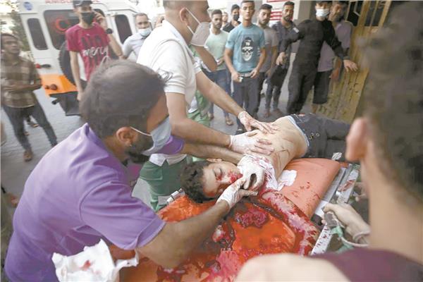 آثار الإصابة على جسد شاب فلسطيني برصاص الاحتلال