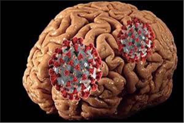  فيروس كورونا يتوغل إلى دماغ الإنسان ويأكل مادته الرمادية