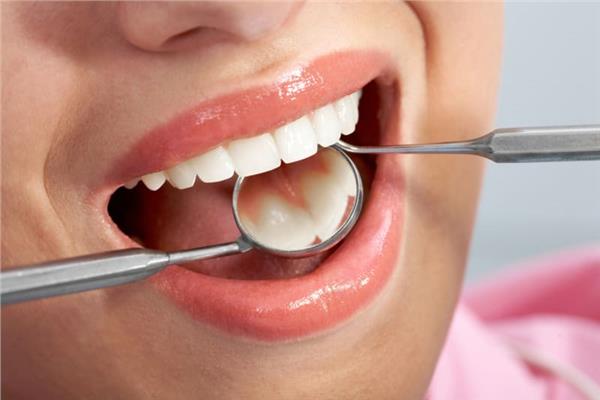 تسوس الأسنان وأمراض اللثة