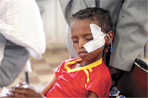 طفل ذو 14 عاما يتلقي العلاج بعد إصابته فى حرب تيجراي