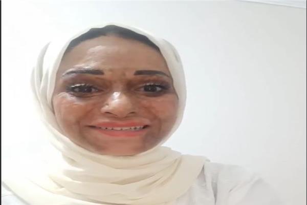 منال حسني بطلة اعلان مستشفى علاج الحروق