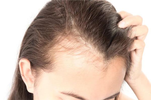 علاج الشعر الخفيف