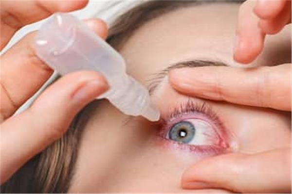 علاج تهيج العين 
