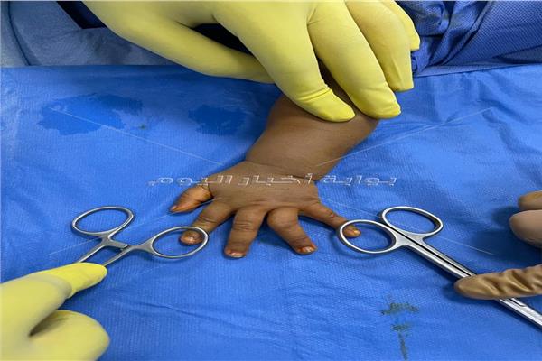 إجراء 98 عملية جراحية منهم عملية منظار جراحي  بالغردقة العام