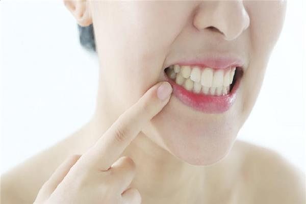  علاج منزلي صيفي فعال لقرحة الفم