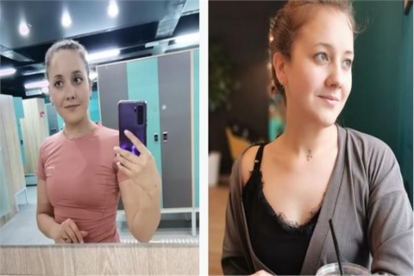 امرأة روسية تكتشف أن قلبها بالجانب اليمين 