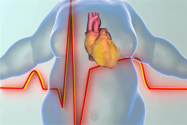 السمنة سبب في الإصابة بفشل القلب  
