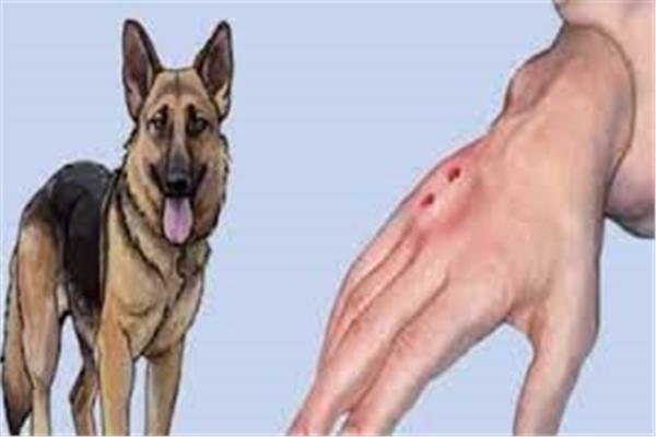 إصابة ممرضة عقرها كلب أثناء عملها بحملة شلل الأطفال بقنا .. صرف مكافأة فورية لها 