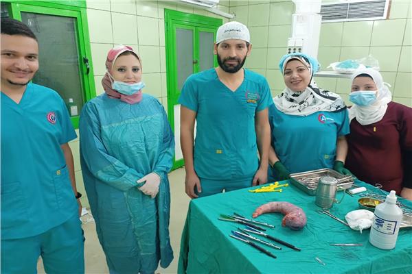 نجاح الفريق الطبي بمستشفى كفر الدوار العام  فى اجراء أول عملية جراحة تكميم للمعدة