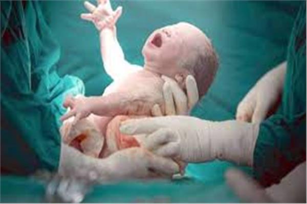 الولادة الطبيعية والقيصرية
