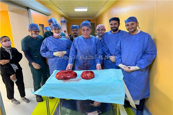 إزالة ورم بالأمعاء يزن 20 كيلو جرام  خلال جراحة بمعهد جنوب مصر للأورام