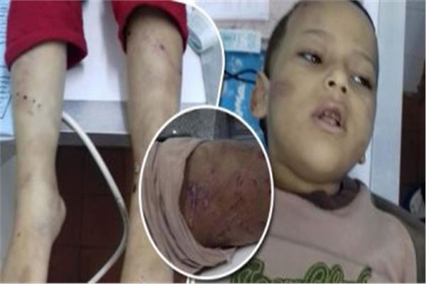 وثقا جريمتهما على «يوتيوب».. ضبط المتهمين بتعذيب طفل وتصويره بالقاهرة 