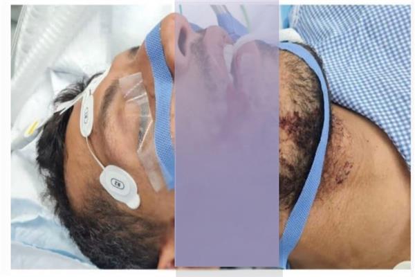 طارق حامد بعد جراحة الوجه