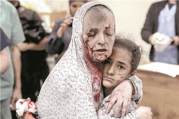 فلسطينية تحتضن طفلتها بعد إصابتها جراء القصف