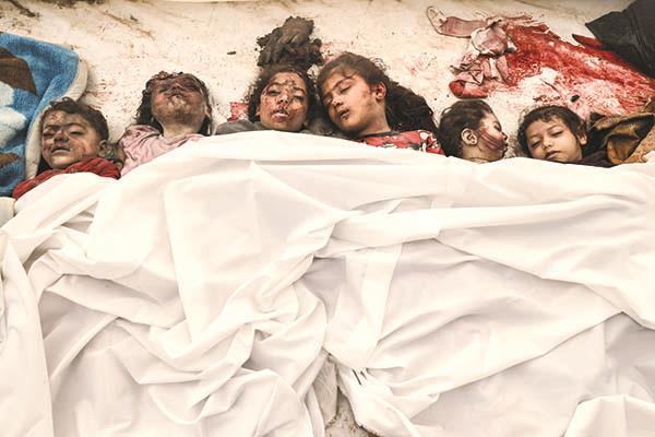 جثامين أطفال شهداء العدوان الإسرائيلى على الأرض بالمستشفى