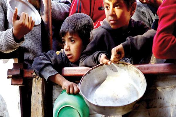 أطفال القطاع يعانون من سوء تغذية