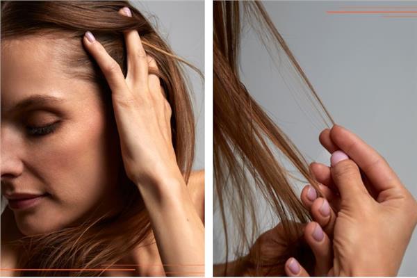 الأسباب الرئيسية لتساقط الشعر 