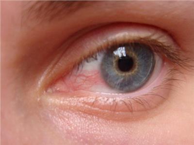 «الأغذية والدواء الأمريكية» توافق على أول جهاز للكشف عن أمراض العين لمرضى السكر 