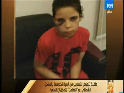 فيديو| تفاصيل تعرض طفلة للتعذيب في الساحل الشمالي