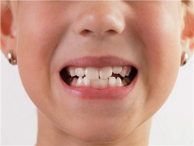 احذر.. العادات السيئة التي تضر بأسنان الأطفال