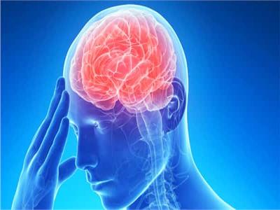 فيديو| تعرف على أسباب «السكتة الدماغية» وطرق الوقاية منها
