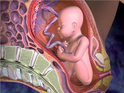 فيديو| الخلايا الجذعية من مشيمة الأمهات يمكنها علاج القلب