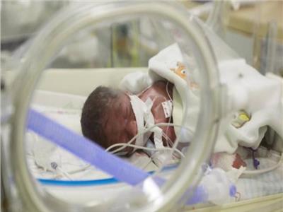 أطباء ليبيون يستأصلون كلى طفلة رضيعة بعد ولادتها بـ18 ساعة